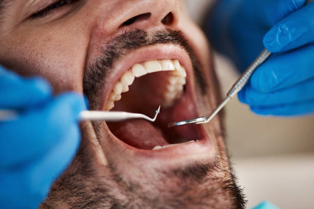 Best Broken or Chipped Tooth Repair in Volcano Golf Course, HI